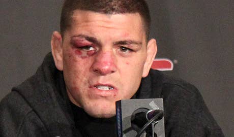 Nick Diaz had to Become the Evil Villain (video)
