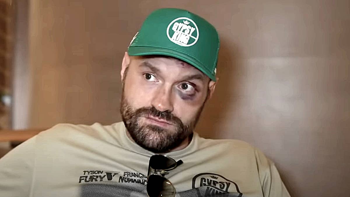 Tyson Fury blames Eddie Hearn for blocking the biggest fight in British boxing history