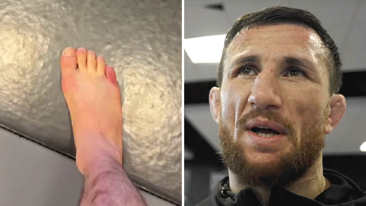 Merab Dvalishvili suffers broken foot days before Sean O’Malley rematch