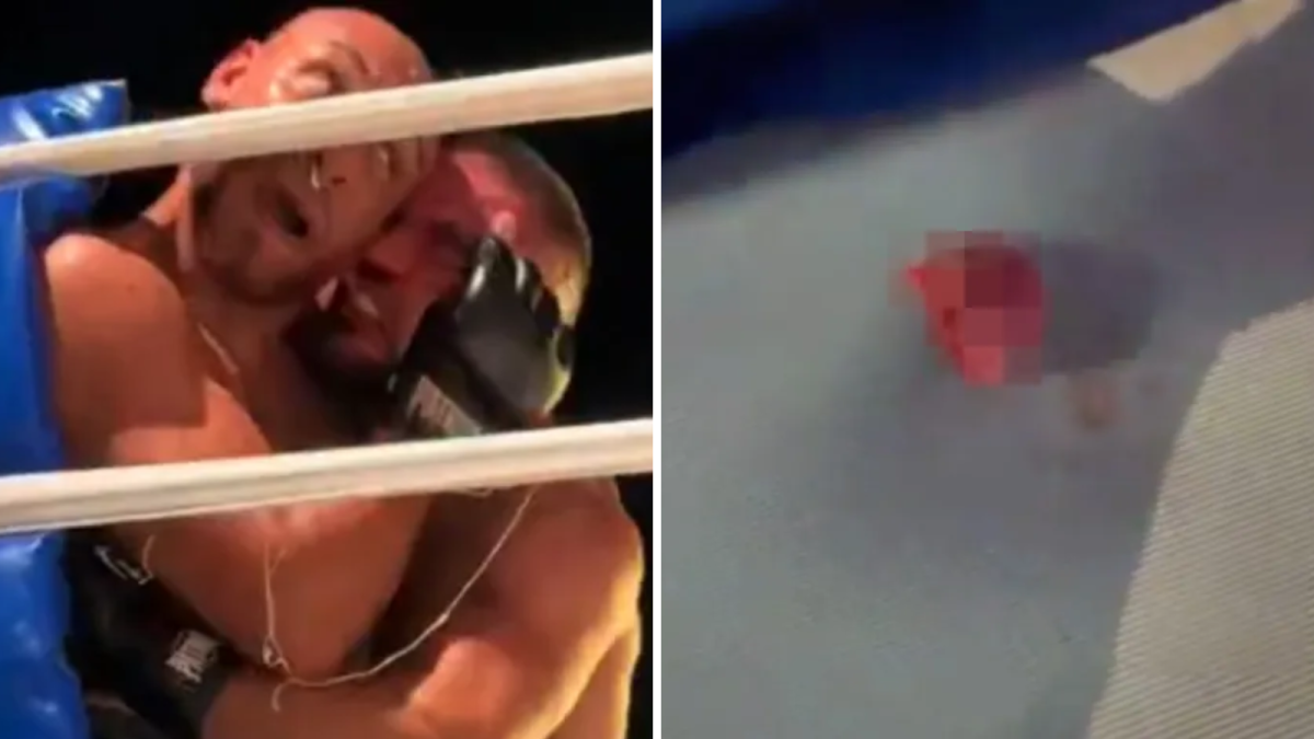 Disturbing footage captures fighter biting opponent’s ear off
