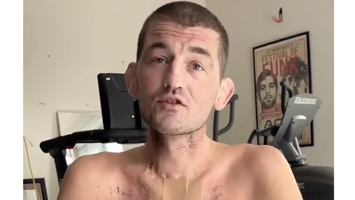 A frail Ben Askren shares inspirational message and health update